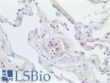 LILRA1 / LIR6 Antibody - Human Lung: Formalin-Fixed, Paraffin-Embedded (FFPE)