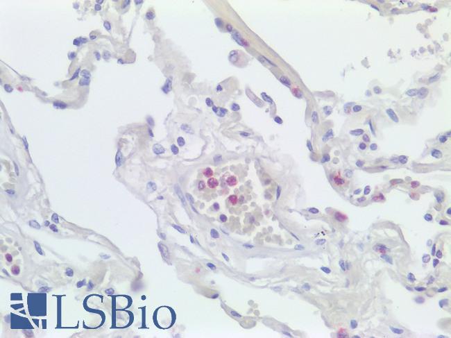 LILRA1 / LIR6 Antibody - Human Lung: Formalin-Fixed, Paraffin-Embedded (FFPE)
