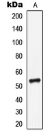 LILRA1 / LIR6 Antibody - Western blot analysis of CD85i expression in MCF7 (A) whole cell lysates.