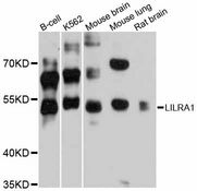 LILRA1 / LIR6 Antibody - Western blot analysis of extracts of various cell lines, using LILRA1 antibody at 1:3000 dilution. The secondary antibody used was an HRP Goat Anti-Rabbit IgG (H+L) at 1:10000 dilution. Lysates were loaded 25ug per lane and 3% nonfat dry milk in TBST was used for blocking. An ECL Kit was used for detection and the exposure time was 60s.