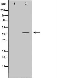 LILRA1 / LIR6 Antibody - Western blot analysis of extracts of HeLa cells using LILRA1 antibody. The lane on the left is treated with the antigen-specific peptide.