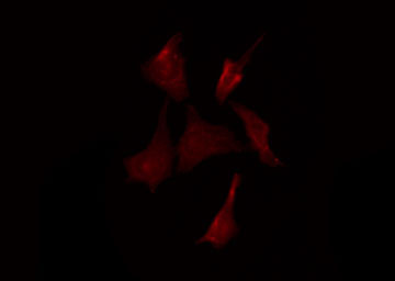 LILRA1 / LIR6 Antibody - Staining HeLa cells by IF/ICC. The samples were fixed with PFA and permeabilized in 0.1% Triton X-100, then blocked in 10% serum for 45 min at 25°C. The primary antibody was diluted at 1:200 and incubated with the sample for 1 hour at 37°C. An Alexa Fluor 594 conjugated goat anti-rabbit IgG (H+L) Ab, diluted at 1/600, was used as the secondary antibody.