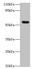 LILRA2 / CD85h / ILT1 Antibody - Western blot All lanes: LILRA2 antibody at 4µg/ml + A549 whole cell lysate Secondary Goat polyclonal to rabbit IgG at 1/10000 dilution Predicted band size: 53, 52, 47, 49 kDa Observed band size: 53 kDa