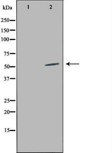 LILRA2 / CD85h / ILT1 Antibody - Western blot analysis of extracts of HepG2 cells using LILRA2 antibody. The lane on the left is treated with the antigen-specific peptide.