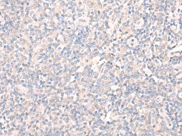 LILRA2 / CD85h / ILT1 Antibody - Immunohistochemistry of paraffin-embedded Human tonsil tissue  using LILRA2 Polyclonal Antibody at dilution of 1:40(×200)