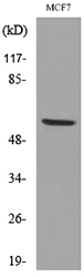 LILRA2+LILRA3 / CD85e+CD85h Antibody - Western blot analysis of lysate from MCF7 cells, using LILRA2/3 Antibody.