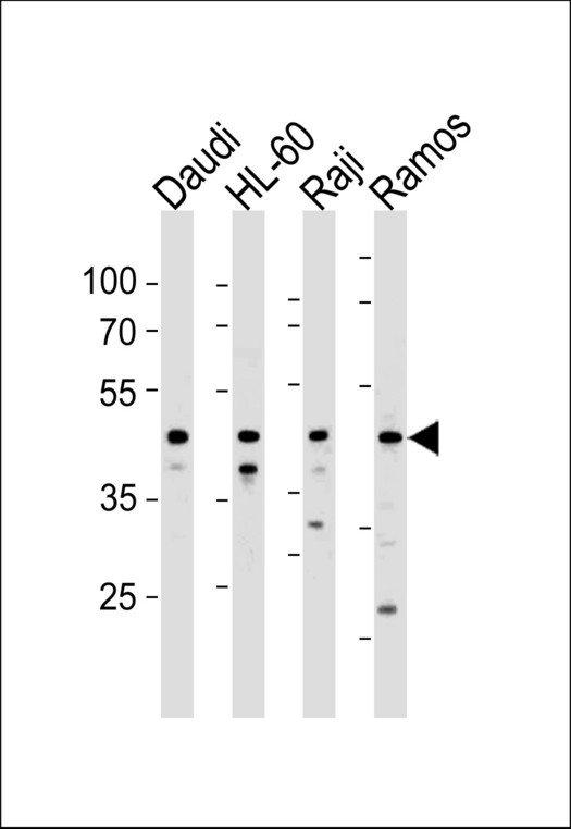 LILRA3 / CD85e Antibody - LILRA3 Antibody western blot of Daudi,HL-60,Raji and Ramos cell line lysates (35 ug/lane). The LILRA3 antibody detected the LILRA3 protein (arrow).