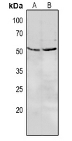 LILRA3 / CD85e Antibody - Western blot analysis of CD85e expression in MCF7 (A), A549 (B) whole cell lysates.