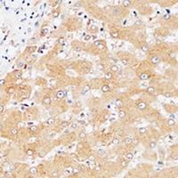 LILRA3 / CD85e Antibody - Immunohistochemical analysis of CD85e staining in human liver formalin fixed paraffin embedded tissue section. The section was pre-treated using heat mediated antigen retrieval with sodium citrate buffer (pH 6.0). The section was then incubated with the antibody at room temperature and detected using an HRP conjugated compact polymer system. DAB was used as the chromogen. The section was then counterstained with haematoxylin and mounted with DPX.