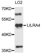 LILRA4 / ILT7 Antibody - Western blot analysis of extracts of LO2 cells.