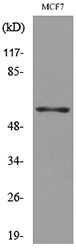 LILRA4 / ILT7 Antibody - Western blot analysis of lysate from MCF7 cells, using LILRA4 Antibody.