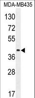 LILRA5 Antibody - LILRA5 Antibody western blot of MDA-MB435 cell line lysates (35 ug/lane). The LILRA5 antibody detected the LILRA5 protein (arrow).