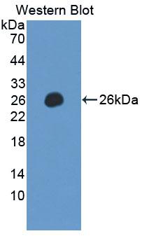 LILRB2 / ILT4 Antibody - Western blot of LILRB2 / ILT4 antibody.