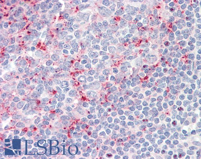 LILRB2 / ILT4 Antibody - Anti-LILRB2 / ILT4 antibody IHC staining of human tonsil. Immunohistochemistry of formalin-fixed, paraffin-embedded tissue after heat-induced antigen retrieval. Antibody concentration 10 ug/ml.  This image was taken for the unconjugated form of this product. Other forms have not been tested.