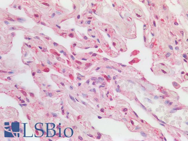 LILRB2 / ILT4 Antibody - Human Lung: Formalin-Fixed, Paraffin-Embedded (FFPE)