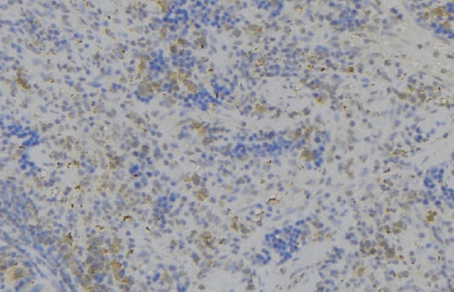 LILRB2 / ILT4 Antibody - 1:100 staining human lymph node tissue by IHC-P. The sample was formaldehyde fixed and a heat mediated antigen retrieval step in citrate buffer was performed. The sample was then blocked and incubated with the antibody for 1.5 hours at 22°C. An HRP conjugated goat anti-rabbit antibody was used as the secondary.