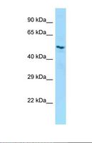 LILRB5 / LIR8 Antibody - Western blot of Human OVCAR-3 . LILRB5 antibody dilution 1.0 ug/ml.  This image was taken for the unconjugated form of this product. Other forms have not been tested.