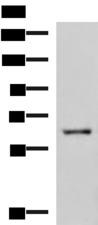 LILRB5 / LIR8 Antibody - Western blot analysis of HepG2 cell lysate  using LILRB5 Polyclonal Antibody at dilution of 1:600