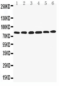LIM Protein / LPP Antibody - WB of LIM Protein / LPP antibody. Lane 1: SMMC Cell Lysate. Lane 2: HELA Cell Lysate. Lane 3: SW620 Cell Lysate. Lane 4: A549 Cell Lysate. Lane 5: SKOV Cell Lysate. Lane 6: MCF-7 Cell Lysate..