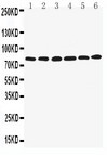 LIM Protein / LPP Antibody - WB of LIM Protein / LPP antibody. Lane 1: SMMC Cell Lysate. Lane 2: HELA Cell Lysate. Lane 3: SW620 Cell Lysate. Lane 4: A549 Cell Lysate. Lane 5: SKOV Cell Lysate. Lane 6: MCF-7 Cell Lysate..