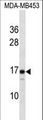 LIM2 Antibody - LIM2 Antibody western blot of MDA-MB453 cell line lysates (35 ug/lane). The LIM2 antibody detected the LIM2 protein (arrow).