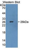 LIM2 Antibody - Western blot of LIM2 antibody.