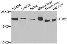 LIM2 Antibody - Western blot analysis of extracts of various cell lines.