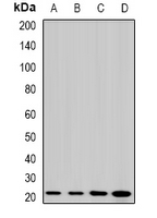 LIM2 Antibody - Western blot analysis of MP19 expression in HepG2 (A); Jurkat (B); mouse eye (C); rat liver (D) whole cell lysates.