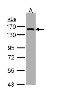 LIMCH1 Antibody - Sample (30g whole cell lysate). A: H1299. 7.5% SDS PAGE. LIMCH1 antibody diluted at 1:3000