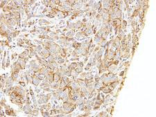 LIMCH1 Antibody - IHC of paraffin-embedded A549 xenograft using LIMCH1 antibody at 1:500 dilution.