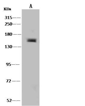 LIMCH1 Antibody - Anti-LIMCH1 rabbit polyclonal antibody at 1:500 dilution. Lane A: H1299 Whole Cell Lysate. Lysates/proteins at 30 ug per lane. Secondary: Goat Anti-Rabbit IgG (H+L)/HRP at 1/10000 dilution. Developed using the ECL technique. Performed under reducing conditions. Predicted band size: 119 kDa.