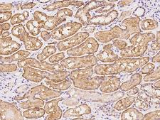 LIMCH1 Antibody - Immunochemical staining of human LIMCH1 in human kidney with rabbit polyclonal antibody at 1:500 dilution, formalin-fixed paraffin embedded sections.