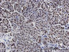 LIMD1 Antibody - Immunoperoxidase of monoclonal antibody to LIMD1 on formalin-fixed paraffin-embedded human pancreas. [antibody concentration 3 ug/ml]