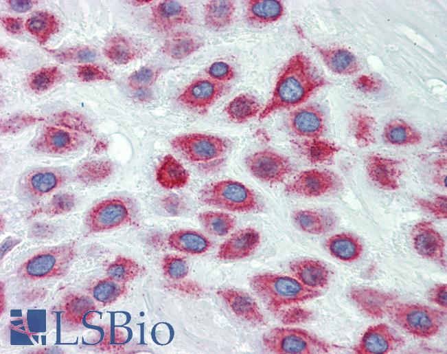 LIMD1 Antibody - Anti-LIMD1 antibody IHC of human placenta. Immunohistochemistry of formalin-fixed, paraffin-embedded tissue after heat-induced antigen retrieval. Antibody concentration 5 ug/ml.  This image was taken for the unconjugated form of this product. Other forms have not been tested.