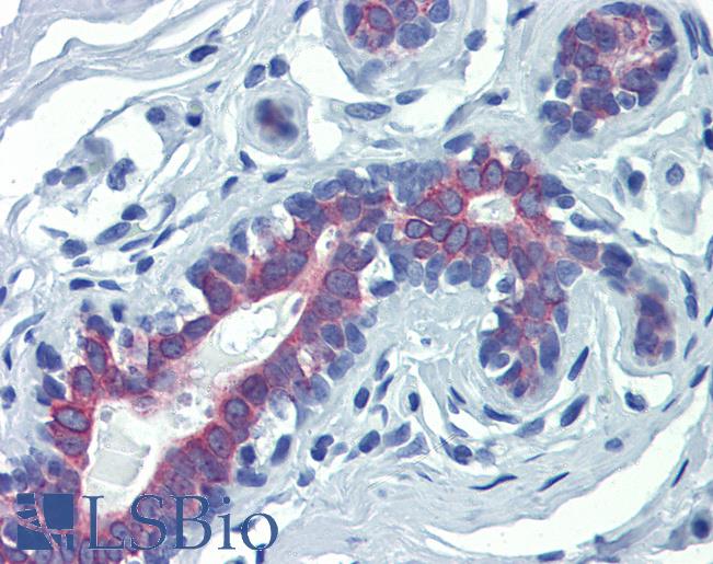 LIMD1 Antibody - Anti-LIMD1 antibody IHC of human breast. Immunohistochemistry of formalin-fixed, paraffin-embedded tissue after heat-induced antigen retrieval. Antibody concentration 5 ug/ml.  This image was taken for the unconjugated form of this product. Other forms have not been tested.