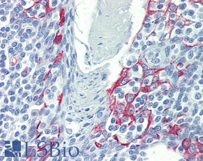LIMD1 Antibody - Anti-LIMD1 antibody IHC of human tonsil. Immunohistochemistry of formalin-fixed, paraffin-embedded tissue after heat-induced antigen retrieval. Antibody concentration 5 ug/ml.  This image was taken for the unconjugated form of this product. Other forms have not been tested.