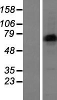 LIMD1 Protein - Western validation with an anti-DDK antibody * L: Control HEK293 lysate R: Over-expression lysate