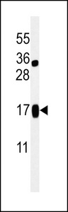 LIMD2 Antibody - Western blot of LIMD2 Antibody in Jurkat cell line lysates (35 ug/lane). LIMD2 (arrow) was detected using the purified antibody.