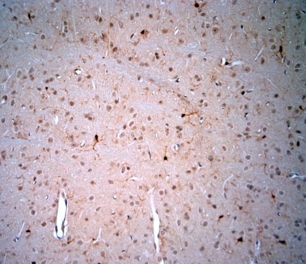 LIMD2 Antibody - IHC-P on paraffin sections of mouse brain. The animal was perfused using Autoperfuser at a pressure of 130 mmHg with 300 ml 4% FA being processed for paraffin embedding. HIER: Tris-EDTA, pH 9 for 20 min using Thermo PT Module. Blocking: 0.2% LFDM in TBST filtered through 0.2 µm. Detection was done using Novolink HRP polymer from Leica following manufacturers instructions; DAB chromogen: Candela DAB chromogen. Primary antibody: dilution 1:1000, incubated 30 min at RT using Autostainer. Sections were counterstained with Harris Hematoxylin.