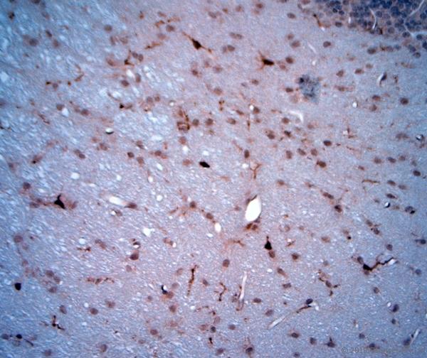 LIMD2 Antibody - IHC-P on paraffin sections of mouse cerebellum. The animal was perfused using Autoperfuser at a pressure of 130 mmHg with 300 ml 4% FA being processed for paraffin embedding. HIER: Tris-EDTA, pH 9 for 20 min using Thermo PT Module. Blocking: 0.2% LFDM in TBST filtered through 0.2 µm. Detection was done using Novolink HRP polymer from Leica following manufacturers instructions; DAB chromogen: Candela DAB chromogen. Primary antibody: dilution 1:1000, incubated 30 min at RT using Autostainer. Sections were counterstained with Harris Hematoxylin.