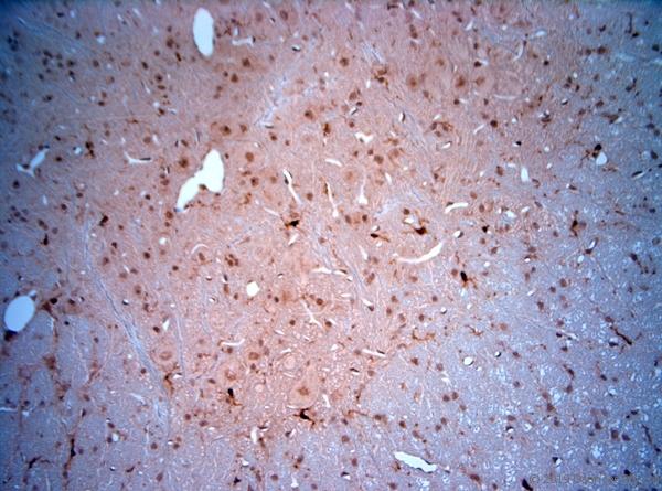 LIMD2 Antibody - IHC-P on paraffin sections of mouse spinal cord. The animal was perfused using Autoperfuser at a pressure of 130 mmHg with 300 ml 4% FA being processed for paraffin embedding. HIER: Tris-EDTA, pH 9 for 20 min using Thermo PT Module. Blocking: 0.2% LFDM in TBST filtered through 0.2 µm. Detection was done using Novolink HRP polymer from Leica following manufacturers instructions; DAB chromogen: Candela DAB chromogen. Primary antibody: dilution 1:1000, incubated 30 min at RT using Autostainer. Sections were counterstained with Harris Hematoxylin.