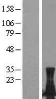 LIMD2 Protein - Western validation with an anti-DDK antibody * L: Control HEK293 lysate R: Over-expression lysate