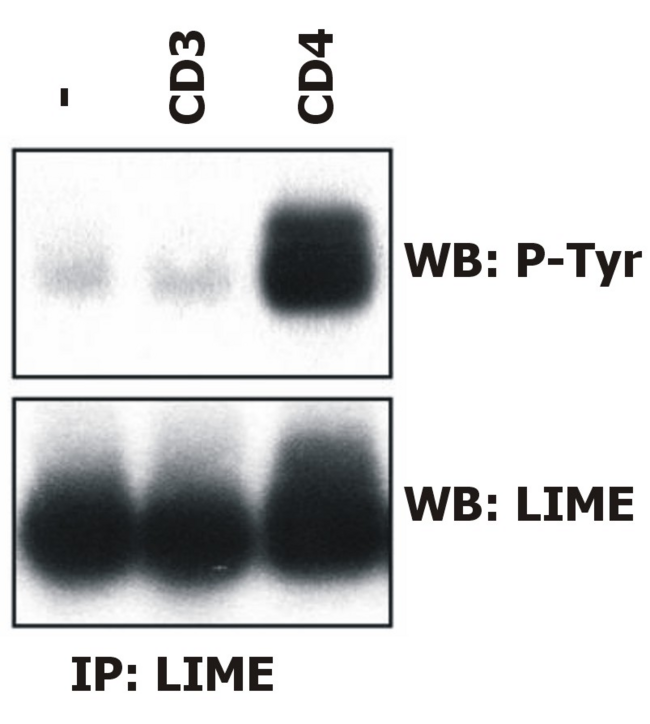 LIME1 / LIME Antibody - Induction of LIME tyrosine phosphorylation.  Peripheral blood T cells were left unstimulated (-) or stimulated with anti-human CD3 (MEM-92)  or anti-human CD4 (MEM-16), and LIME was immunoprecipitated from laurylmaltoside lysates with the LIME-06 antibody (immunoaffinity sorbent) and analyzed by Western blotting to visualize tyrosine-phosphorylated LIME (top) and total LIME (bottom).