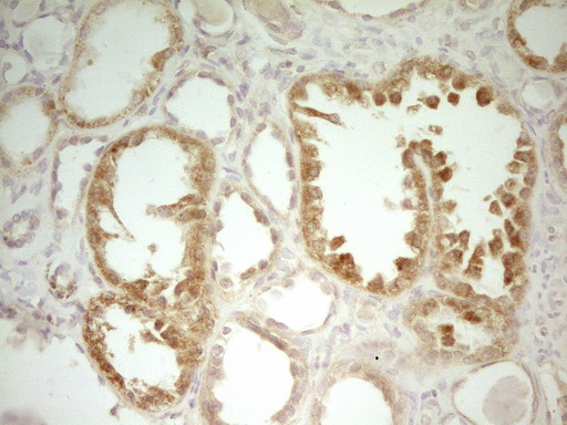 LIME1 / LIME Antibody - Immunohistochemical staining of paraffin-embedded Human Kidney tissue within the normal limits using anti-LIME1 mouse monoclonal antibody. (Heat-induced epitope retrieval by 1 mM EDTA in 10mM Tris, pH8.5, 120C for 3min,