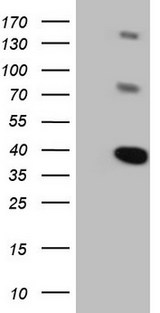 LIME1 / LIME Antibody - HEK293T cells were transfected with the pCMV6-ENTRY control (Left lane) or pCMV6-ENTRY LIME1 (Right lane) cDNA for 48 hrs and lysed. Equivalent amounts of cell lysates (5 ug per lane) were separated by SDS-PAGE and immunoblotted with anti-LIME1.