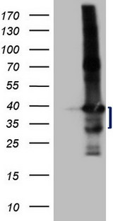 LIME1 / LIME Antibody - HEK293T cells were transfected with the pCMV6-ENTRY control. (Left lane) or pCMV6-ENTRY LIME1. (Right lane) cDNA for 48 hrs and lysed