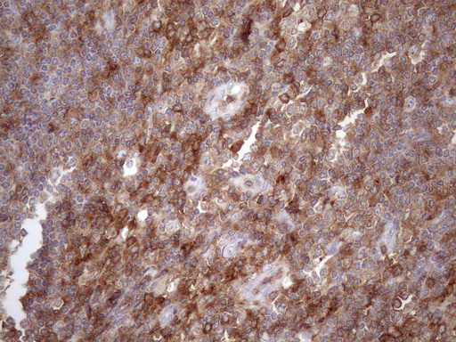 LIME1 / LIME Antibody - Immunohistochemical staining of paraffin-embedded Human lymph node tissue within the normal limits using anti-LIME1 mouse monoclonal antibody. (Heat-induced epitope retrieval by 1mM EDTA in 10mM Tris buffer. (pH8.5) at 120 oC for 3 min. (1:150)