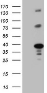 LIME1 / LIME Antibody - HEK293T cells were transfected with the pCMV6-ENTRY control. (Left lane) or pCMV6-ENTRY LIME1. (Right lane) cDNA for 48 hrs and lysed. Equivalent amounts of cell lysates. (5 ug per lane) were separated by SDS-PAGE and immunoblotted with anti-LIME1.