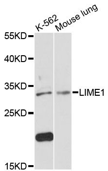 LIME1 / LIME Antibody - Western blot analysis of extracts of various cell lines, using LIME1 antibody at 1:3000 dilution. The secondary antibody used was an HRP Goat Anti-Rabbit IgG (H+L) at 1:10000 dilution. Lysates were loaded 25ug per lane and 3% nonfat dry milk in TBST was used for blocking. An ECL Kit was used for detection and the exposure time was 90s.