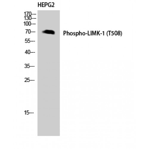 LIMK1 / LIMK Antibody - Western blot of Phospho-LIMK-1 (T508) antibody